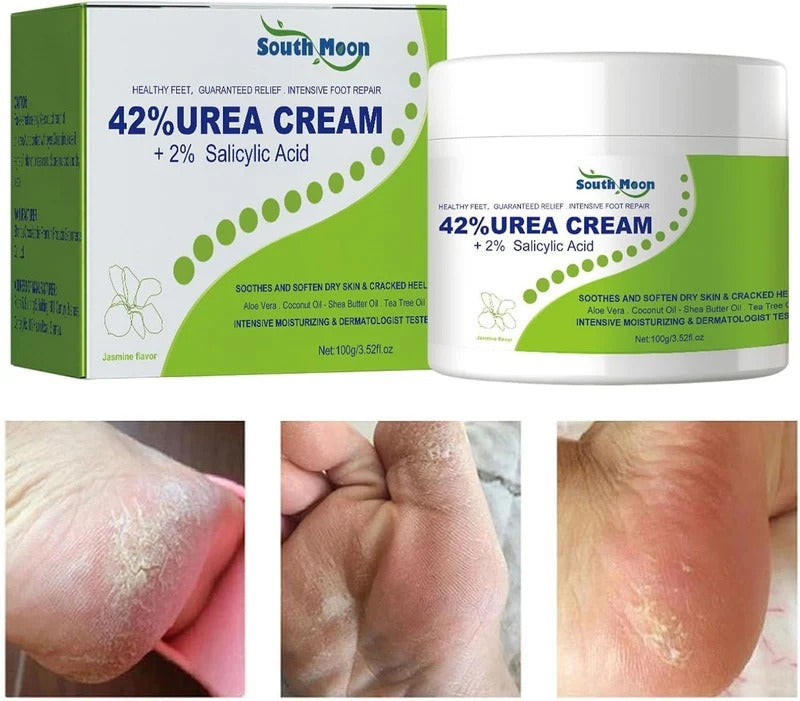 South Moon - 42% Urea Cream + 2% Salicylic Acid