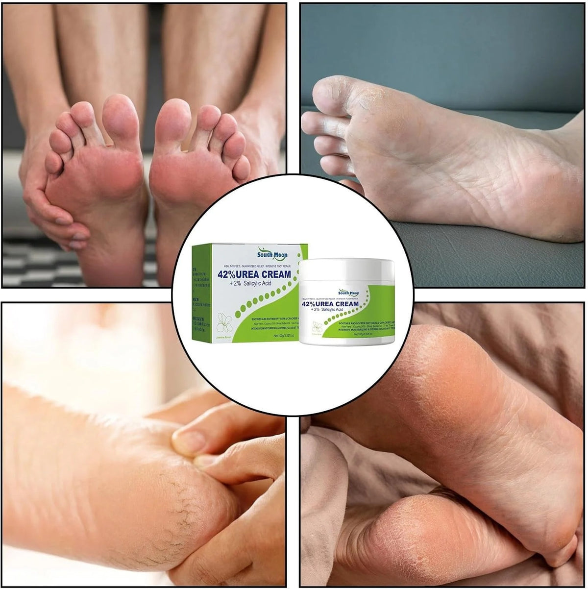 South Moon - 42% Urea Cream + 2% Salicylic Acid